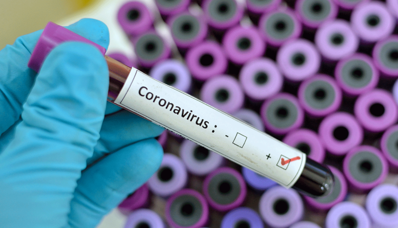 Vai ir pieejami preparāti, ko varētu izmantot pret koronavīrusu?