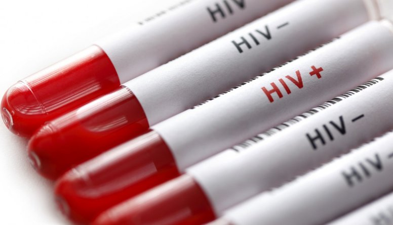 Latvijā HIV un AIDS jaunatklāto inficēto pacientu skaits turpina pieaugt