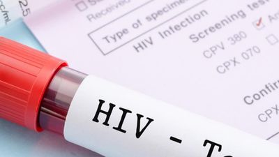 Kā noskaidrot vai neesi HIV inficēts?