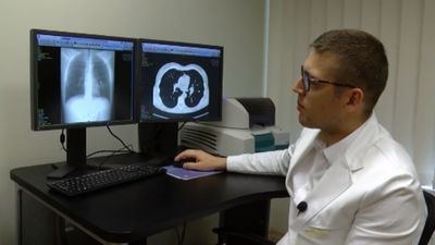 Noskaties, kā tiek veikta plaušu vēža diagnostika