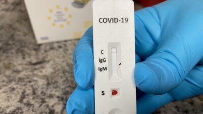 Vai Covid-19 antivielu testi ir lieka naudas izšķiešana?