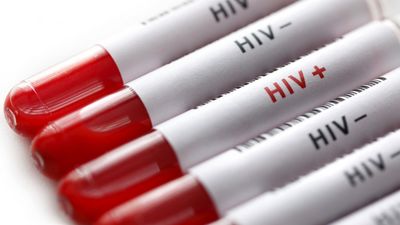 Latvijā HIV un AIDS jaunatklāto inficēto pacientu skaits turpina pieaugt