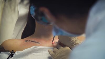 Medicīnas studente Marija uzsāk savu ceļu tetovējumu likvidēšanā
