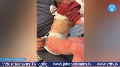 Aizbildņi apšauba Jēkabpils mediķu rīcību bērna ārstēšanā