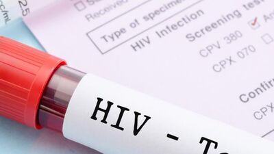 Latvijā notiek HIV testēšanas nedēļa